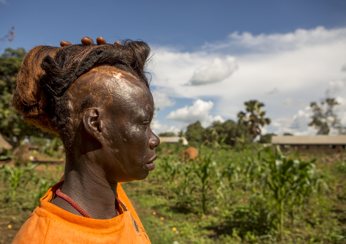 Polline Angeyo lifts her wig to reveal scars from the 1995 LRA attack on her home village of Awach in northern Uganda. Polline's story is one of many which will be told at the Global Eyewitness showcase Nov. 16.
